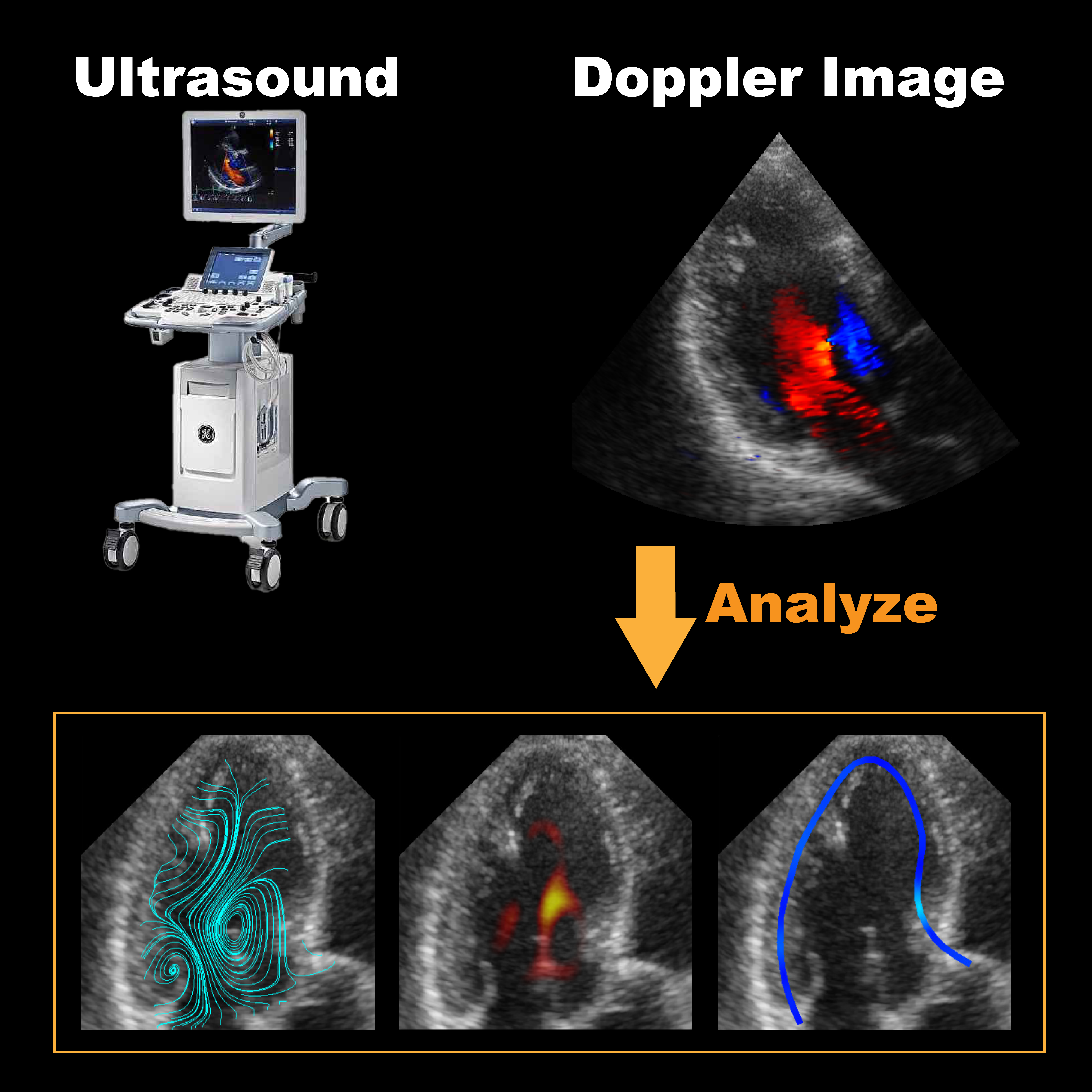 Visualize blood flow from a single image of echocardiography
